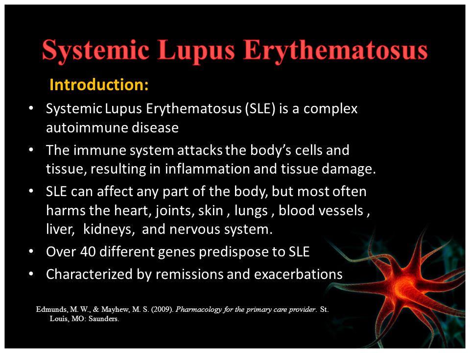 Diagnosis of Systemic Lupus Erythematosus